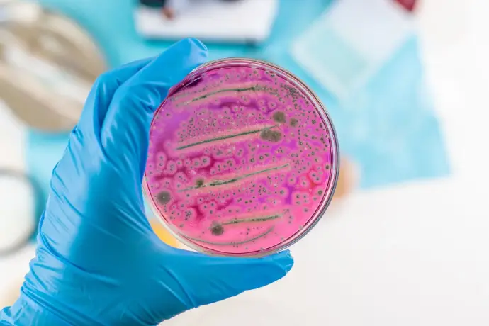 Antimicrobial Resistance (AMR)